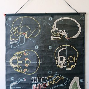 Original ANATÓMICO Vintage Mid Century French School Chalk Wall Chart SKULL TEETH Dentition Dentistry Dental Anatomy Rare Dr Auzoux Sougy