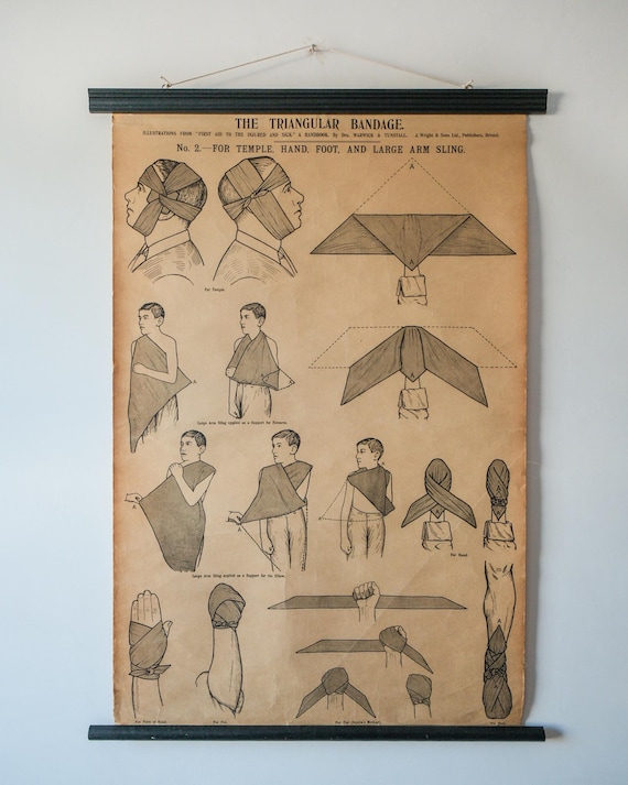 Original ANATOMICAL Vintage British School Wall Chart TRIANGULAR BANDAGE Broken Bones Anatomy Wright & Sons First Aid Sling