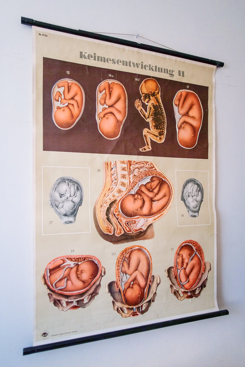 Original ANATOMICAL Vintage German Educational School Wall Chart ...