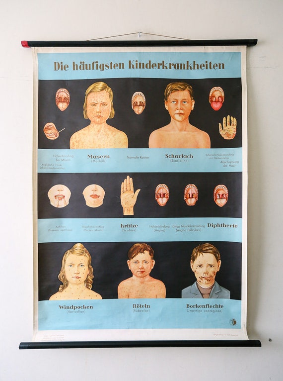 Original ANATOMICAL Vintage German School Wall Chart CHILDHOOD DISEASES Measles Chicken Pox Anatomy Medicine Science Beautiful Rare