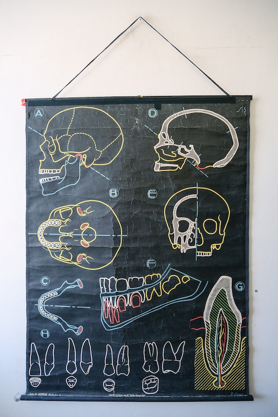 Original ANATOMICAL Vintage Mid Century French School Chalk Wall Chart SKULL TEETH Dentition Dentistry Dental Anatomy Rare Dr Auzoux Sougy