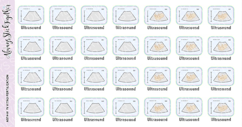 IVF, Fertility, in Vitro Stickers Perfect for Your Planner, Journal, or ...