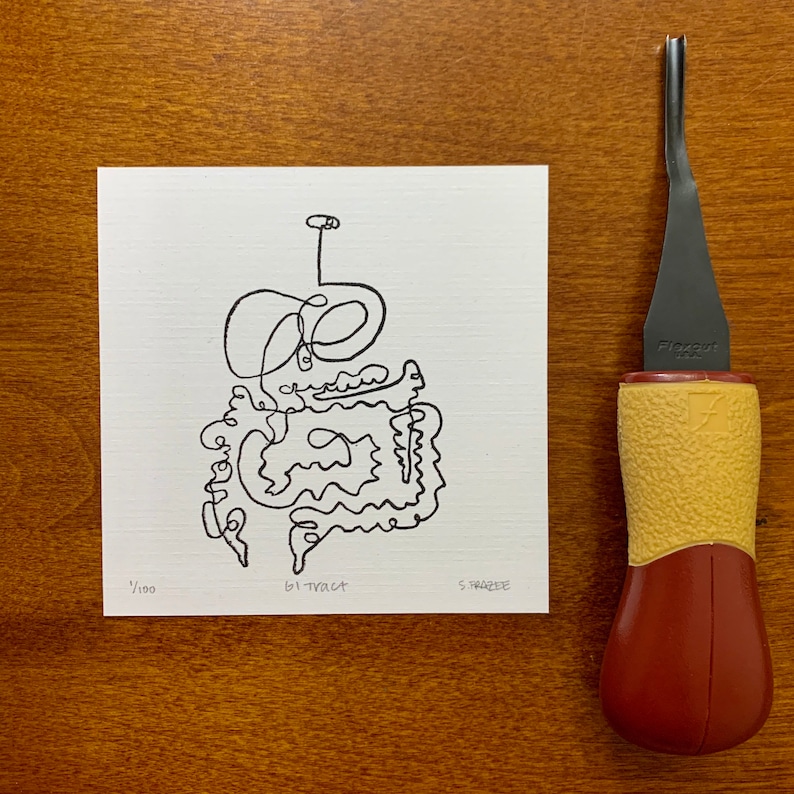 Gastrointestinal Tract Print, Tiny Art, Lino Print, Anatomy Art, Biology Art, Organs, Linocut, Lino Print Wall Art, Weird Art, Linocut Print image 2