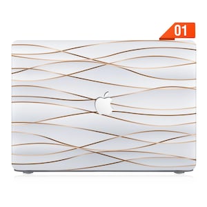 Case for MacBook 2025 Air 13 Pro 13, Pro 14, Pro 16, MacBook Air 13, Air 15 - Supports M1 M2 M3 M4 chips, customizable design Luxury