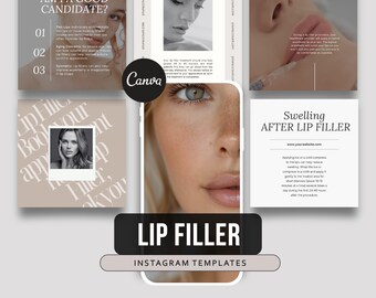 100 Lip Filler Templates | Medspa Templates | Injector Instagram templates | Esthetician Template | Filler Templates | Nurse Injector Post