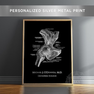 Orthopedic Surgeon Gift - Personalized Thank You Gift For Doctor - Hip Surgery Replacement - Hip Joint Anatomy Art Framed Wall Decor Metal