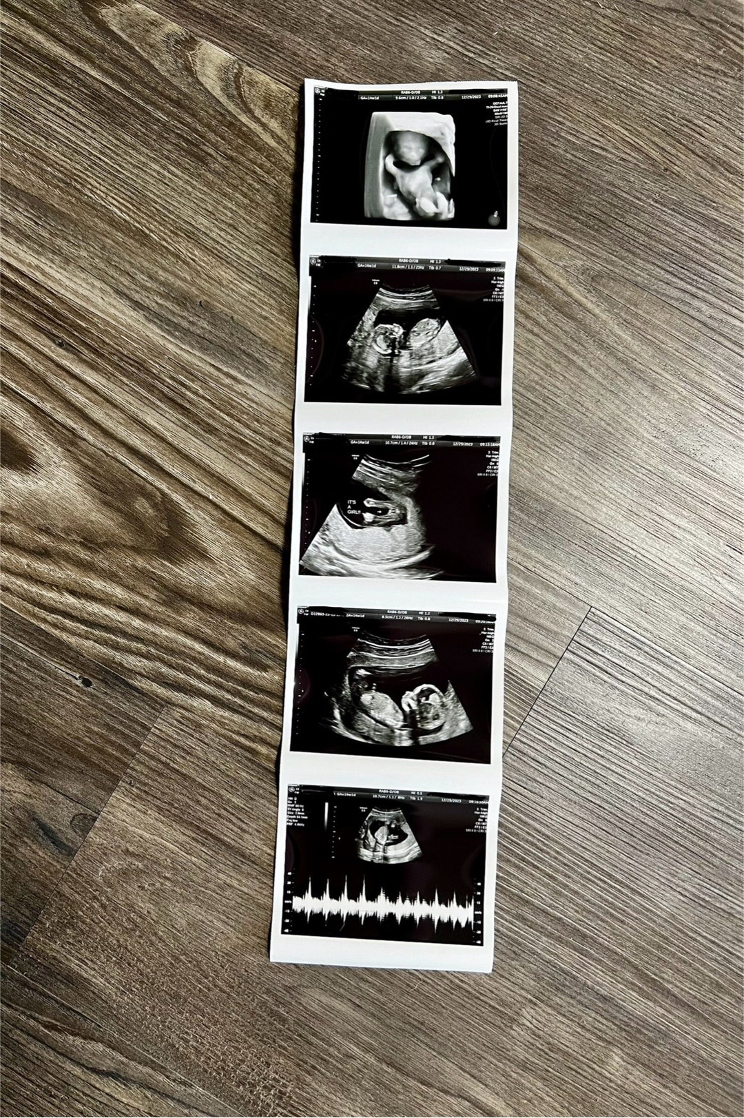 Custom Printed Ultrasound Strip Etsy