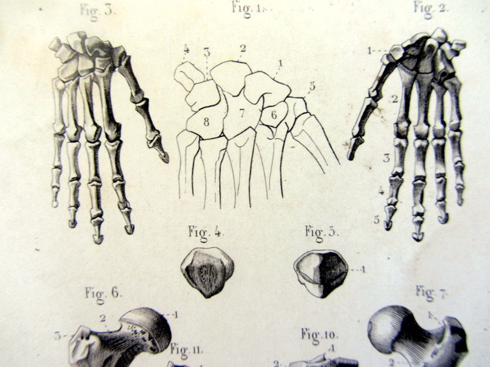 1846 antique anatomy print of HAND and LENG BONES original | Etsy