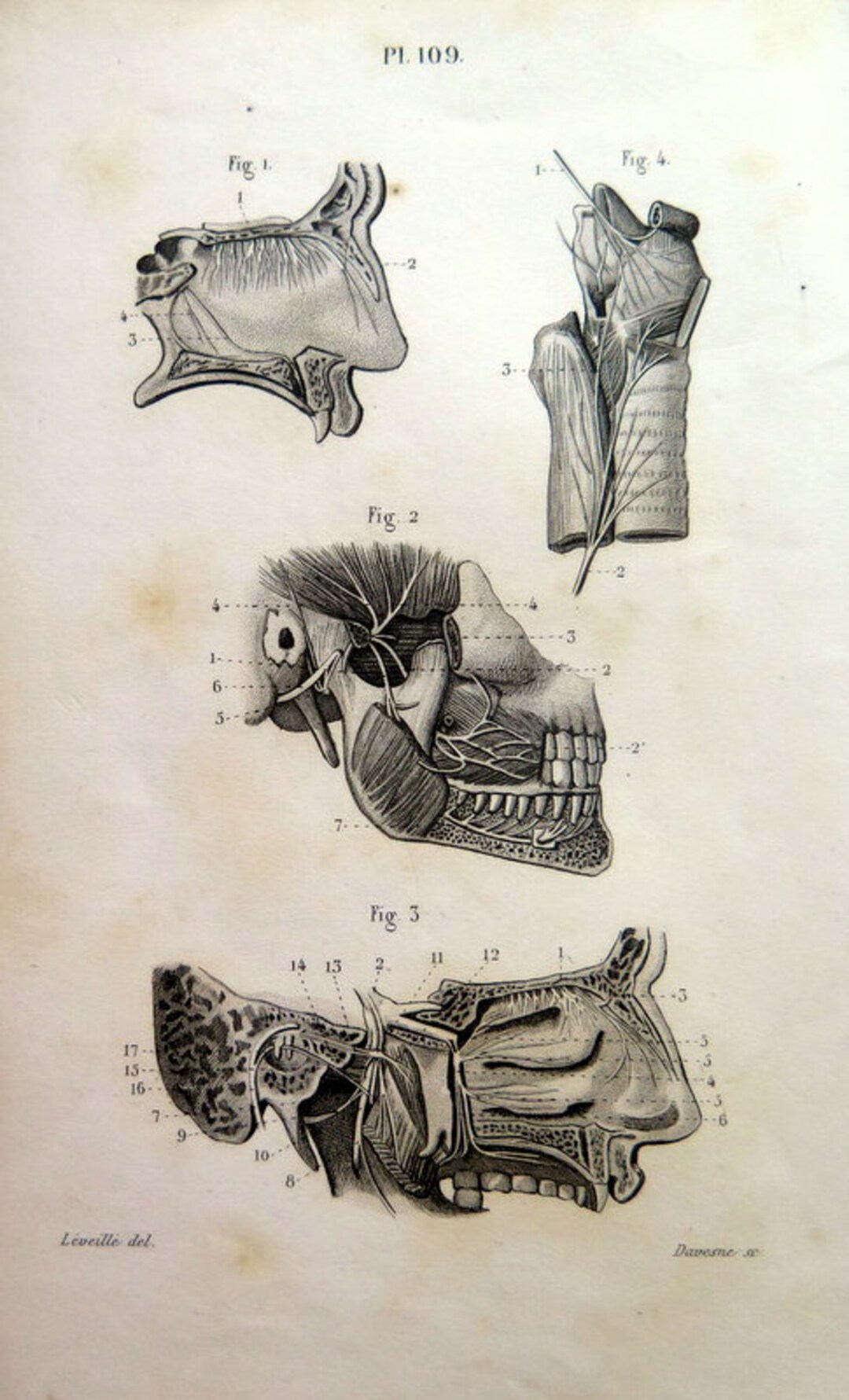 1846 Antique ANATOMY ENGRAVING Vintage Print of Larynx Mouth - Etsy