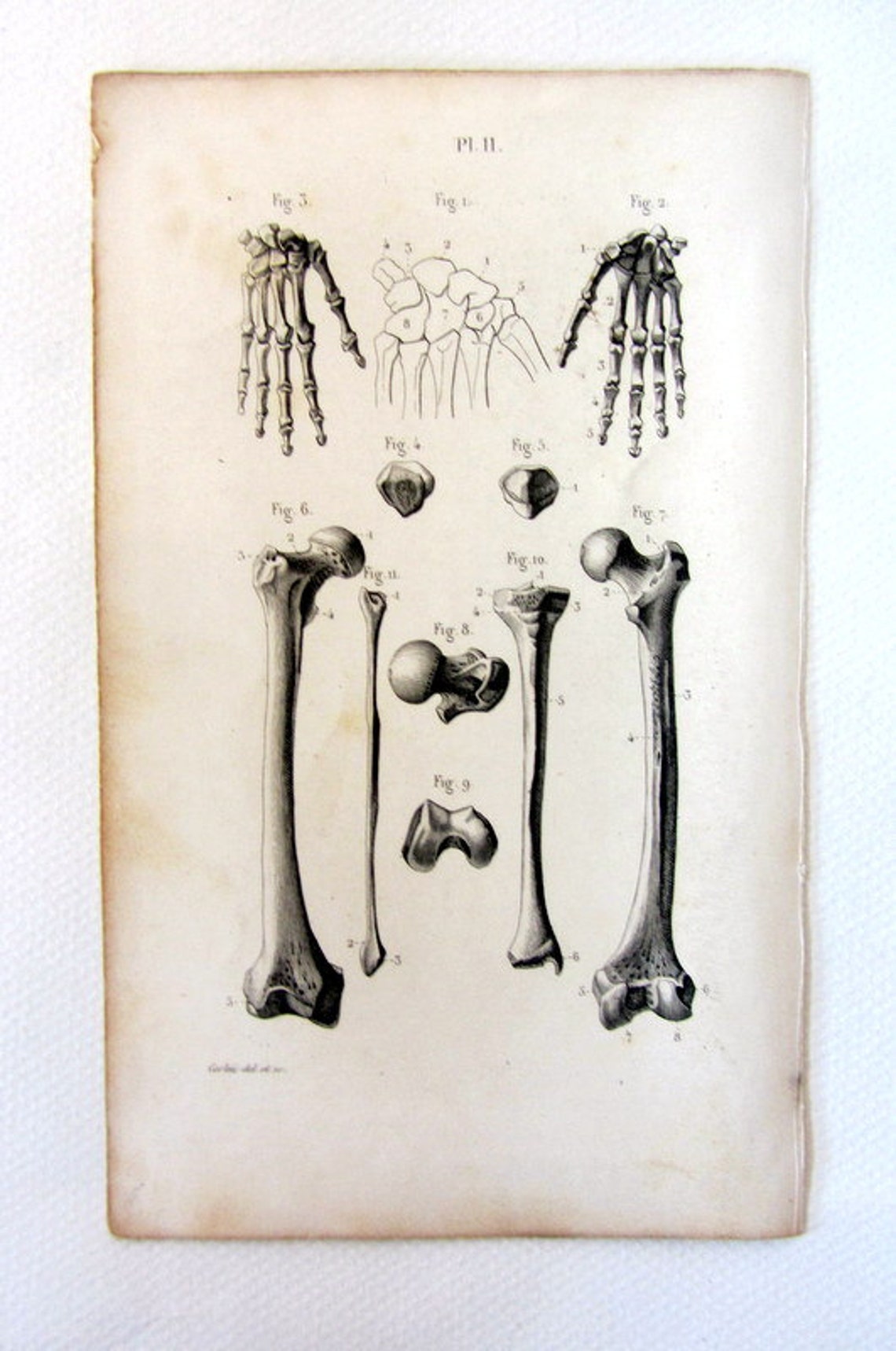 1846 antique anatomy print of HAND and LENG BONES original | Etsy