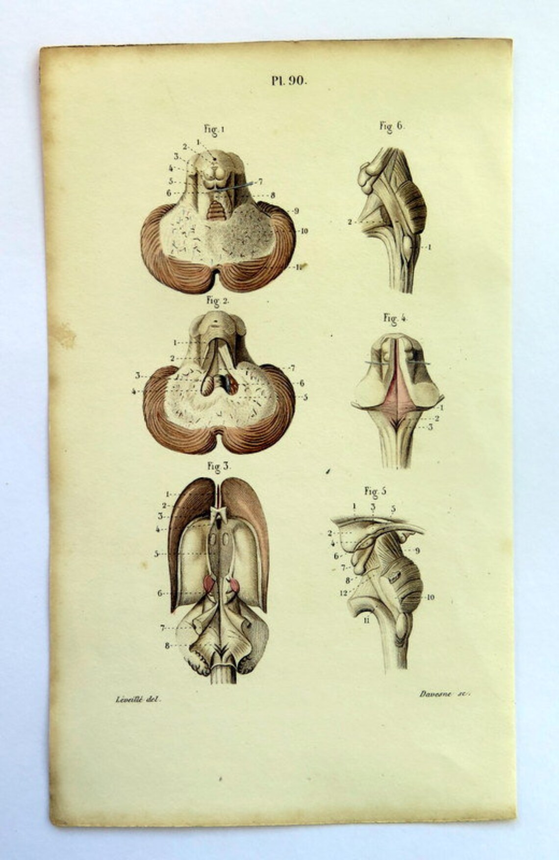1846 Antique Rare Anatomy Engraving Diferents Part of - Etsy