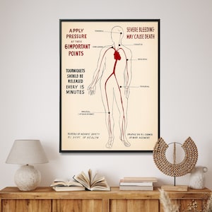 First Aid: Stop Bleeding Points - WW2 Vintage Chart Print, Doctor's Office Wall Art, Ideal Medical Gift