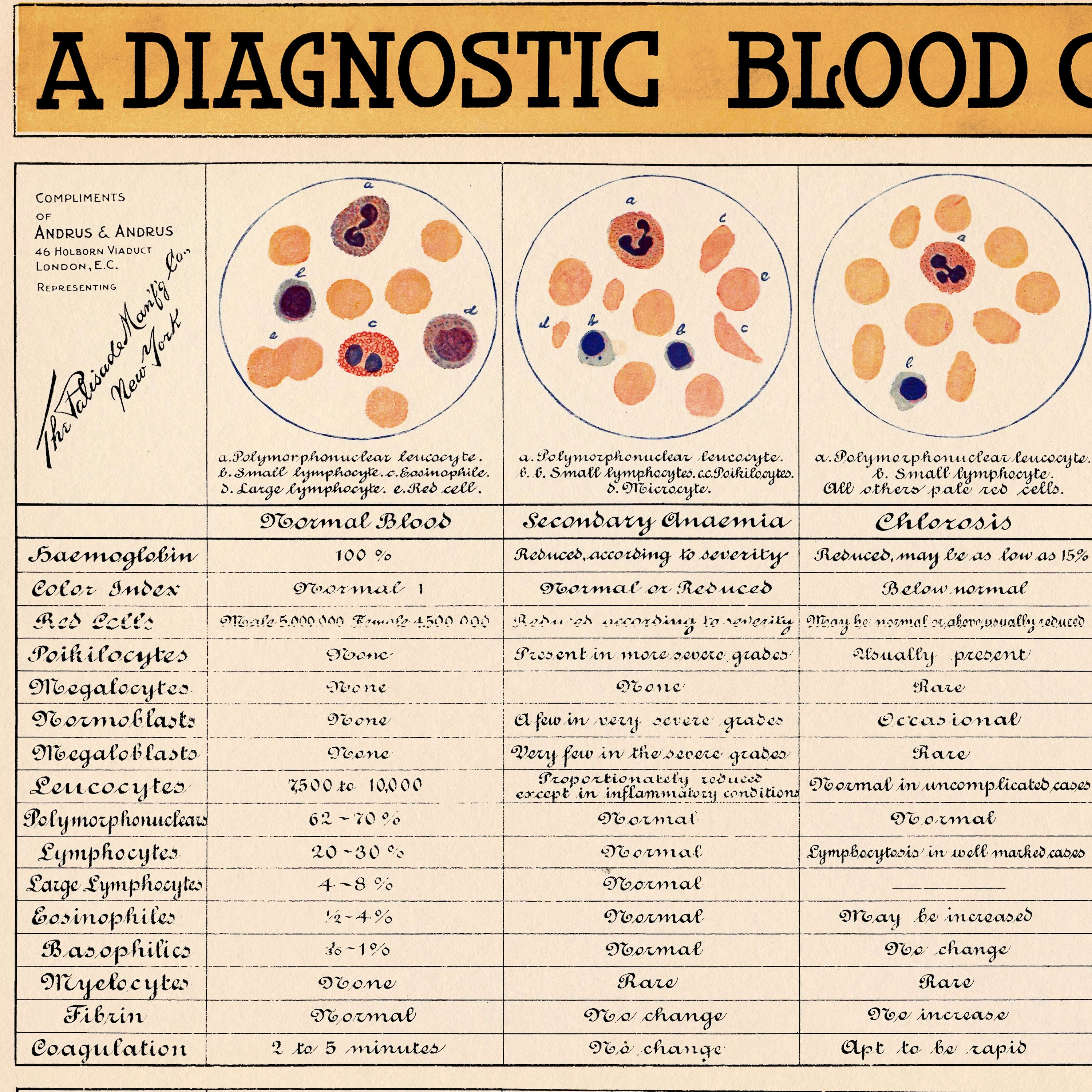 Vintage Diagnostic Blood Chart, Doctor's Office Wall Art, Ideal Medical ...