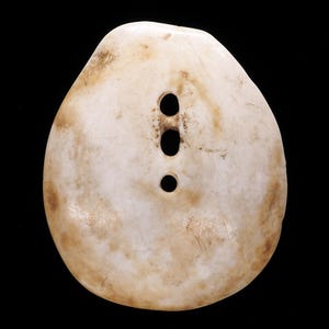 May include: An irregular, oval-shaped button with a smooth, off-white surface featuring mottled brown and tan patches. The button has three vertically aligned holes in the center, with the top two holes connected by a narrow channel.