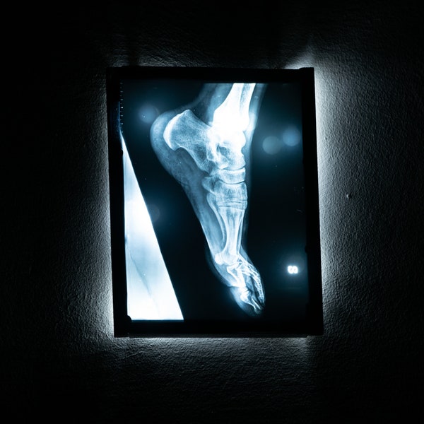 X-ray led lighted picture with foot, skeleton brighted sign, anatomical wall decor for goth home and doctor's office, radiography picture