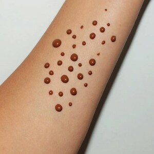 May include: Close-up of an arm with numerous brown droplets of varying sizes. The droplets are scattered across the skin, creating a textured pattern. The skin tone is light brown, and the background is a plain white.