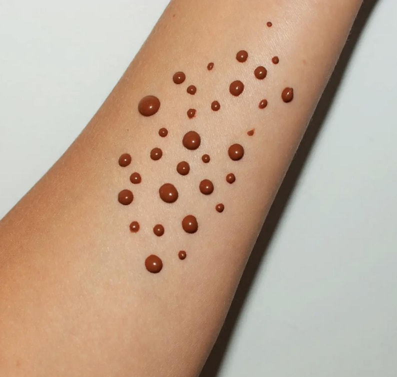May include: Close-up of an arm with numerous brown droplets of varying sizes. The droplets are scattered across the skin, creating a textured pattern. The skin tone is light brown, and the background is a plain white.