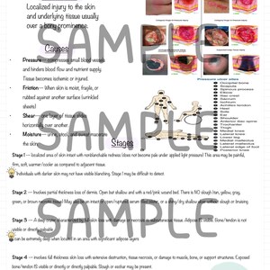 May include: A diagram illustrating the different stages of pressure injuries, also known as bedsores. The diagram shows the progression of the injury from stage 1 to stage 4, with descriptions of each stage. The diagram also includes a list of common pressure ulcer sites on the body.