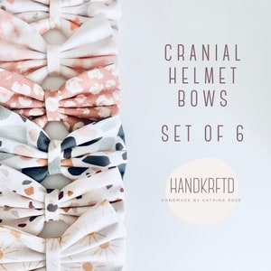May include: Set of six handmade cranial helmet bows. The bows are made of fabric with different patterns, including pink and white polka dots, pink and white floral, gray and white geometric, and beige and white sunburst. The bows are arranged in a vertical stack.