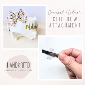 May include: A white cranial helmet with a floral bow attachment. The bow features a pattern of small flowers in shades of brown, beige, and green. The helmet has the name "Melody" in gold script. The image also shows a metal clip.