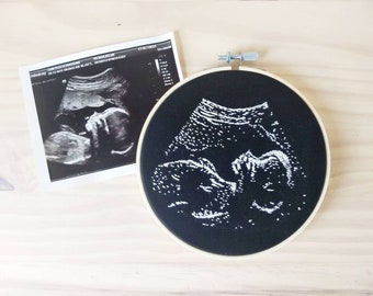 Custom hand embroider ultrasound Custom sonogram embroidery Personalized Embroidered ultrasound. Custom ultrasound embroidery