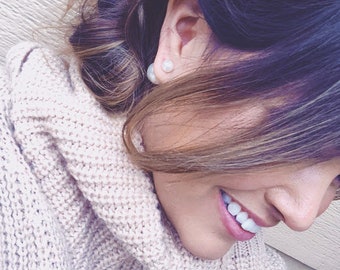 Faux Marble Double Ball Stud Earrings: White & Grey Resin Pearl Jacket