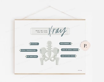 Chiropractic X-ray Poster - What we are looking for on Xray