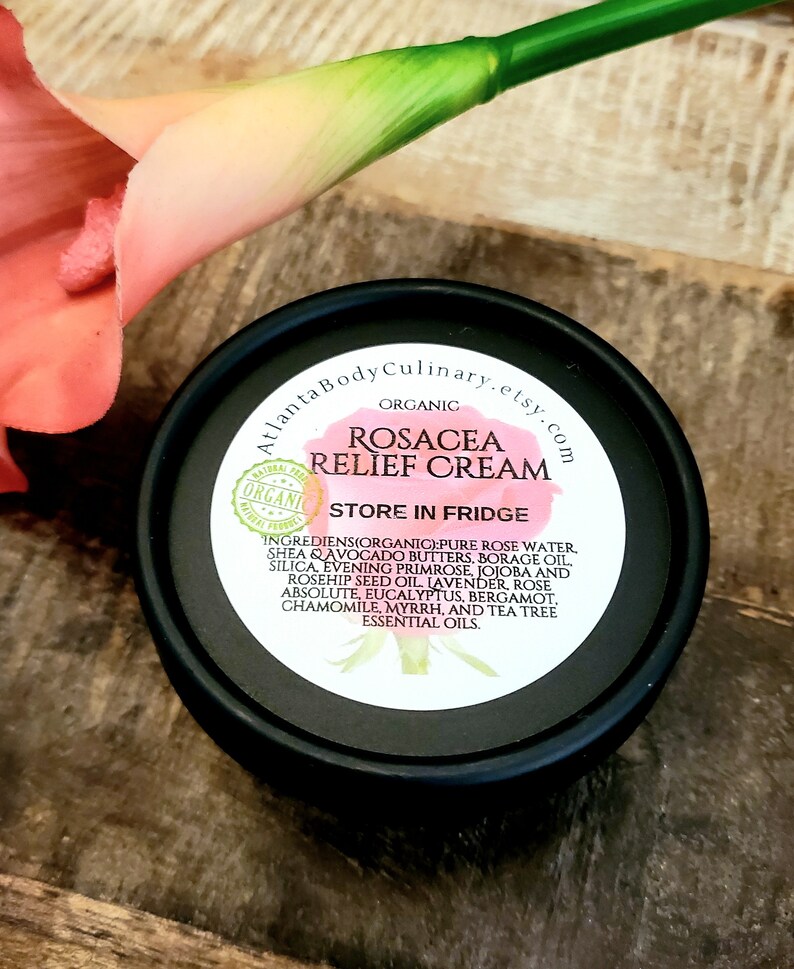 Rosacea Relief Cream Organic Pure Rose Based Rosacea Balm Etsy
