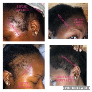Clove Water Hair Growth Spray