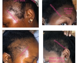 Clove Hair Growth Oil | Clove Rosemary Shampoo | Clove Water Spray | Clove conditioner