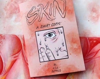 Skin - bande dessinée