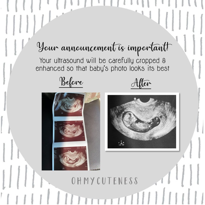 May include: Before and after images of an ultrasound. The before image shows a blurry ultrasound image. The after image shows a clear, enhanced ultrasound image of a baby in the womb. The text "Your announcement is important!" is at the top of the image. The text "Before" and "After" are above the images. The text "OHMYCUTENESS" is at the bottom of the image.