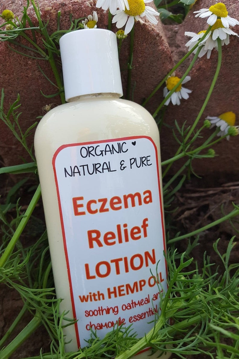 Organic Eczema Relief Lotion Eczema Lotion hemp lotion Etsy