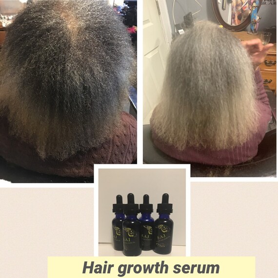 Quicker Results Hair Growth Oil Thinning Edges Castor Etsy