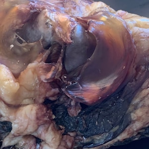 May include: Close-up of a raw, uncooked piece of meat. The meat is a dark red color and has a lot of marbling. It is covered in a thin layer of fat. The meat is sitting on a black surface.