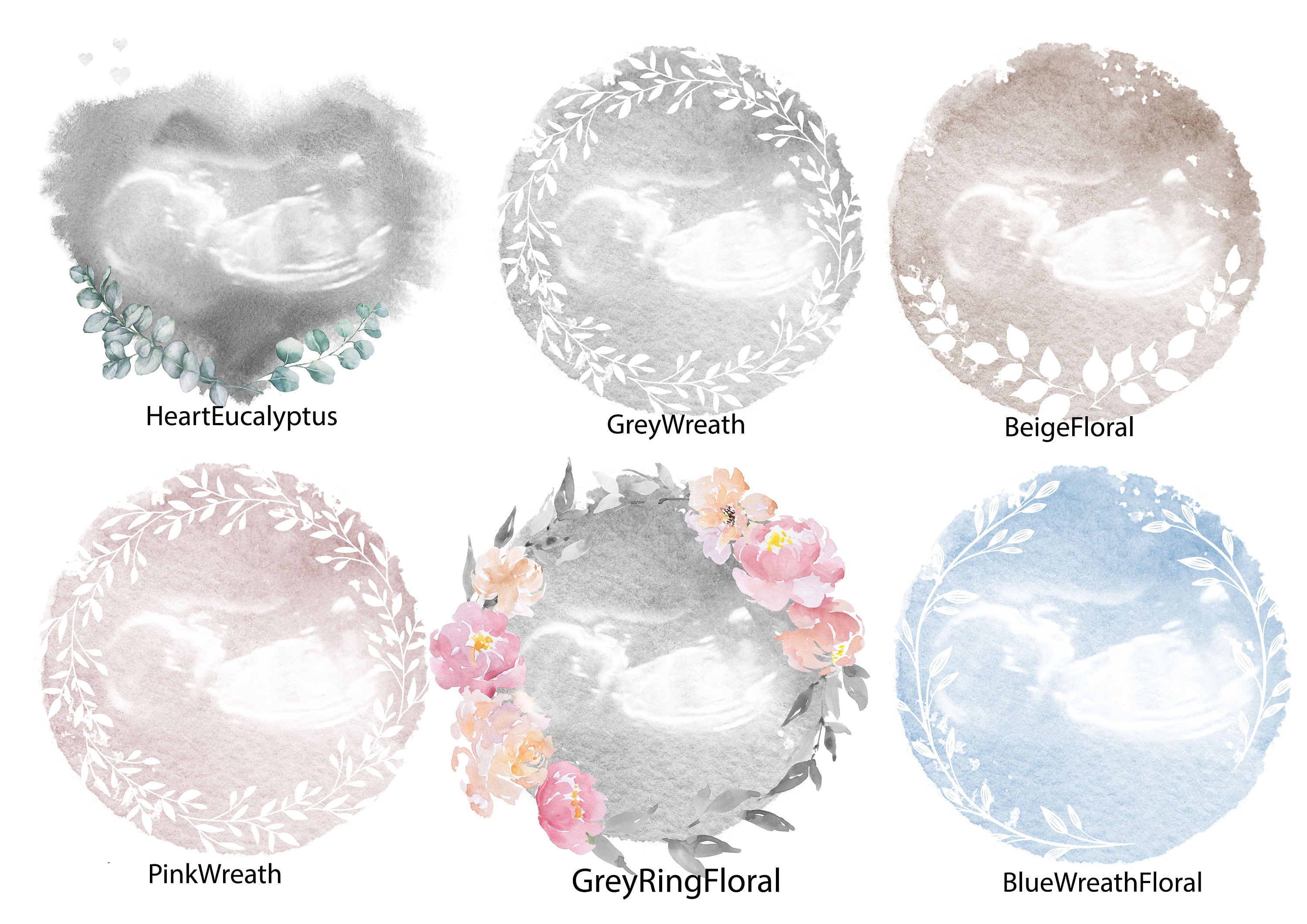 Baby Scan Ultrasounds Sonogram Print Unframed A4 Etsy