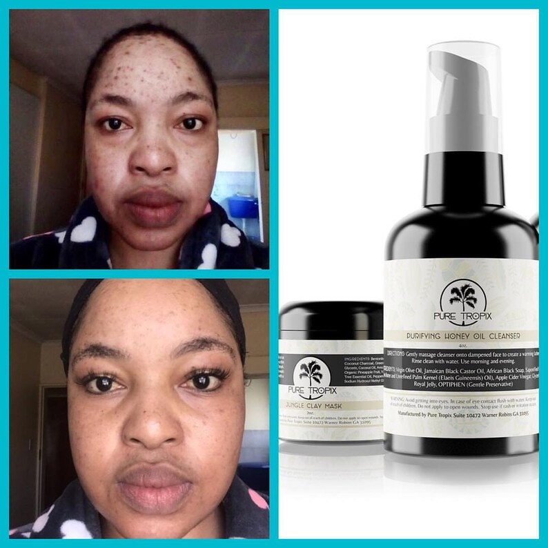 Ultimate Glow Skin Perfecting Facial Kit, Plant Extract Toner, Omega