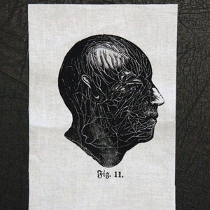 May include: Black and white illustration of a human head with a detailed network of lines representing the veins and arteries of the face. The image is labelled "Fig. 11."