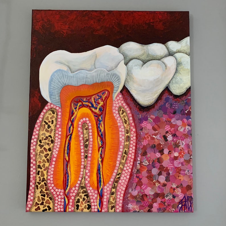 Tooth Painting Root Canal Painting Teeth Artwork Medical Etsy