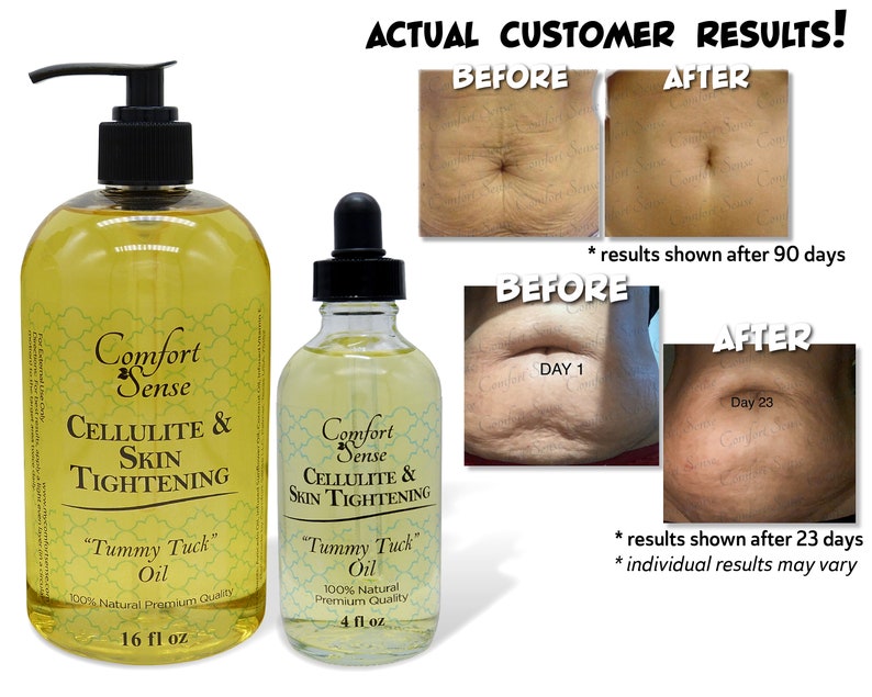 comfortsense tummy tuck cream