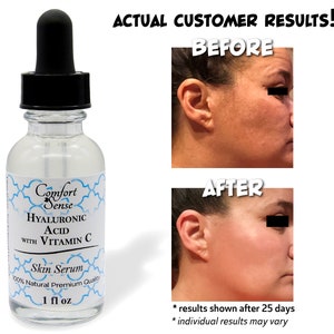 Skin Care Face Serum, Hyaluronic Acid with Vitamin C & Vitamin E