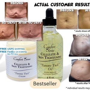 comfortsense tummy tuck cream