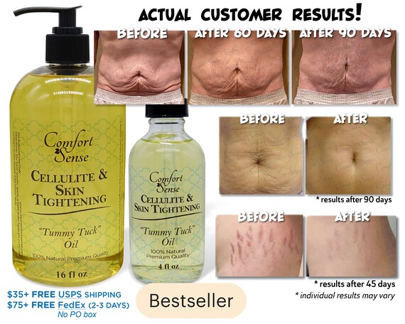 comfortsense tummy tuck cream