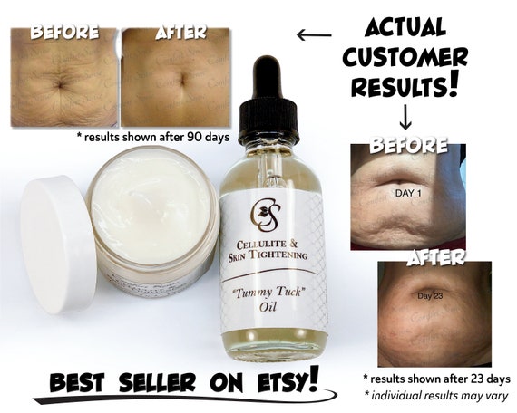 comfortsense tummy tuck cream