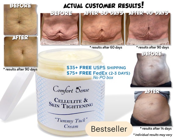 Cellulite Skin Tightening Tummy Tuck Cream For Etsy