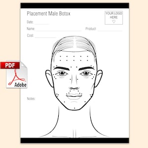 May include: A black and white line drawing of a man's face with dots marking injection points. The drawing is on a white sheet of paper with the text "Placement Male Botox" at the top. The text "Date", "Name", "Cost", "Product", and "Notes" are also included on the sheet.
