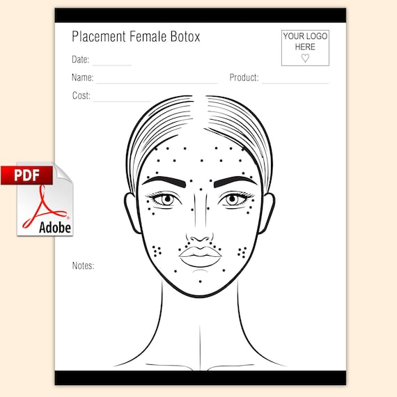 Placement Female Botox template PDF document, small business fillable file, custom PDF, digital PDF, fillable form, editable pdf document