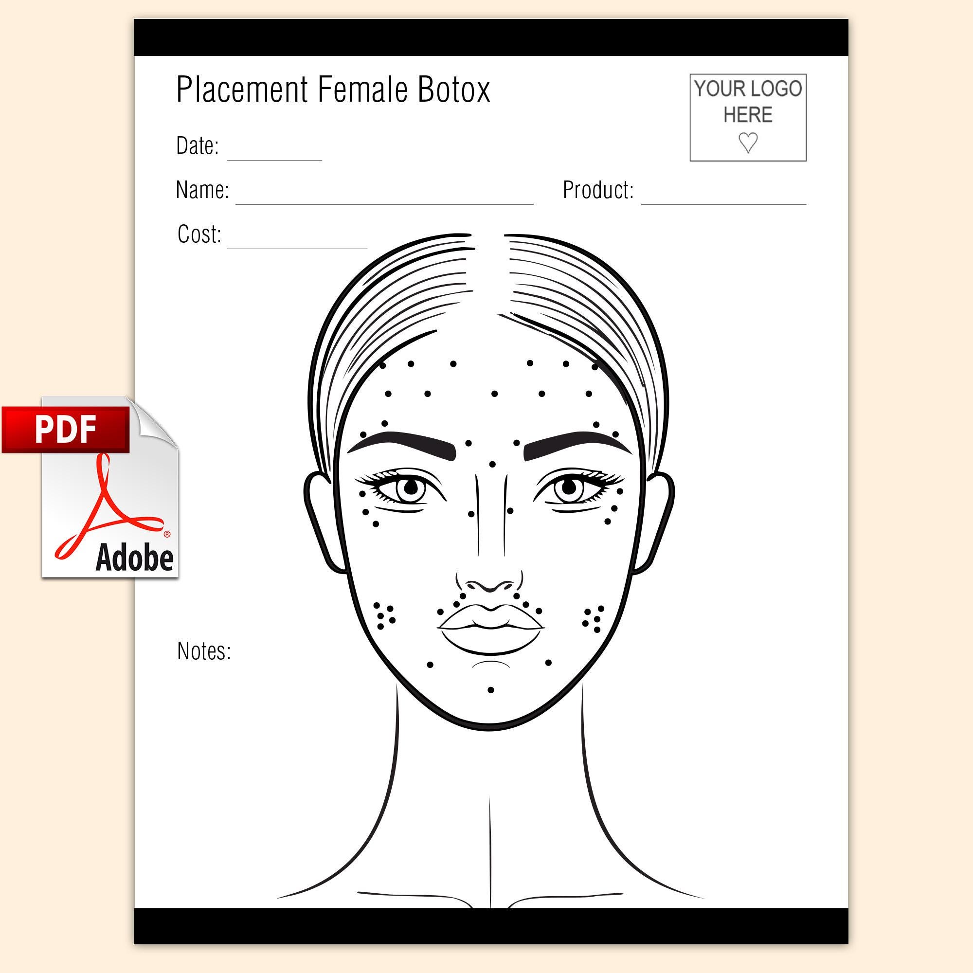 Botox Charting Pdf - Etsy UK for Free Printable Botox Face Chart Pdf