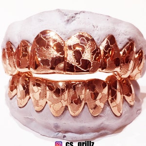 925 Sterling Silver Rose Gold Plated w/ Nugget Cut Custom Fit Handmade Real Grill Grillz image 1