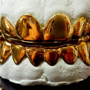 Peut inclure: Grilles en or avec un moule blanc, montrant les dents de devant et les dents du fond. La grille est brillante et a un design pointu et tranchant.